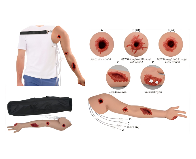Multi‑Wound Hemorrhage Control Arm - Product Image
