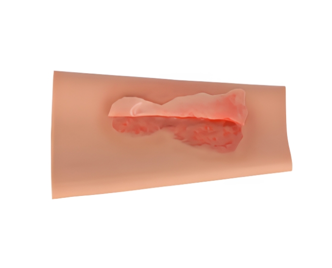 Abrasion Wound Care Simulation Sleeve - Product Image