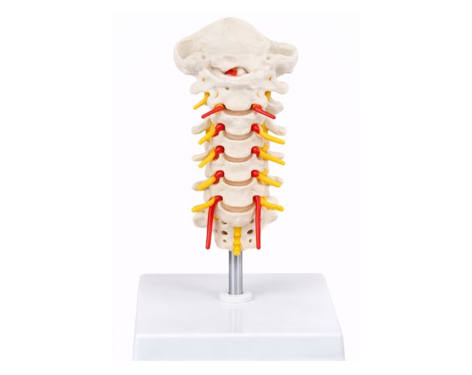 Occipital cervical vertebrae with vertebral artery model