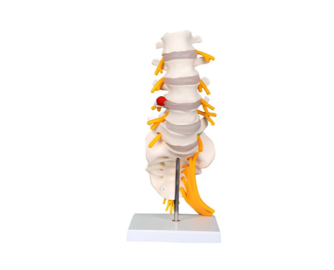Lumbar Sacrum with Herniated Disc Model - Product Image