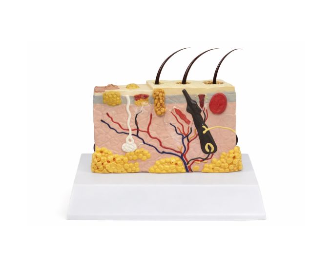 Human Skin Pathology Anatomy Model for Medical Study - Product Image