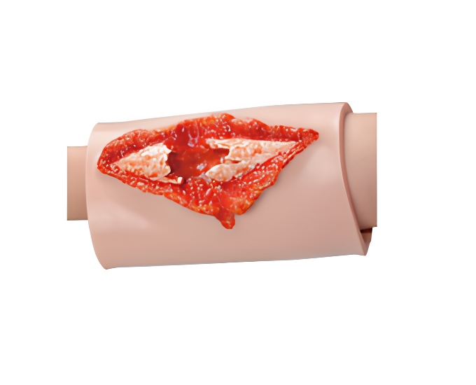 Wearable Fractures Wound Sleeve - Product Image