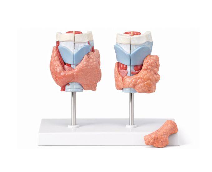 Thyroid Disease Anatomy Model 4 Parts - Product Image
