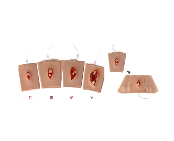 Wearable Open Fracture Wound Packing Trainer - Product Image