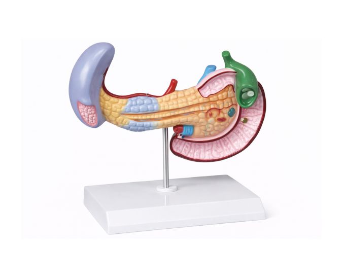 Pathological Spleen Model with Pancreas and Duodenum - Product Image