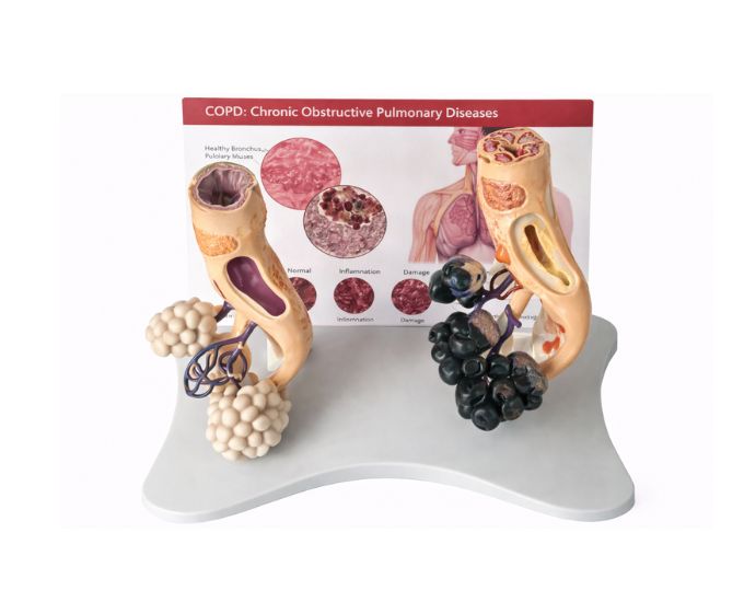 Comparative Lung Alveolus Model for Smoking and Non-Smoking Study - Product Image