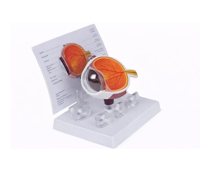 Cataracts Eye Model with Educational Card for Medical Training