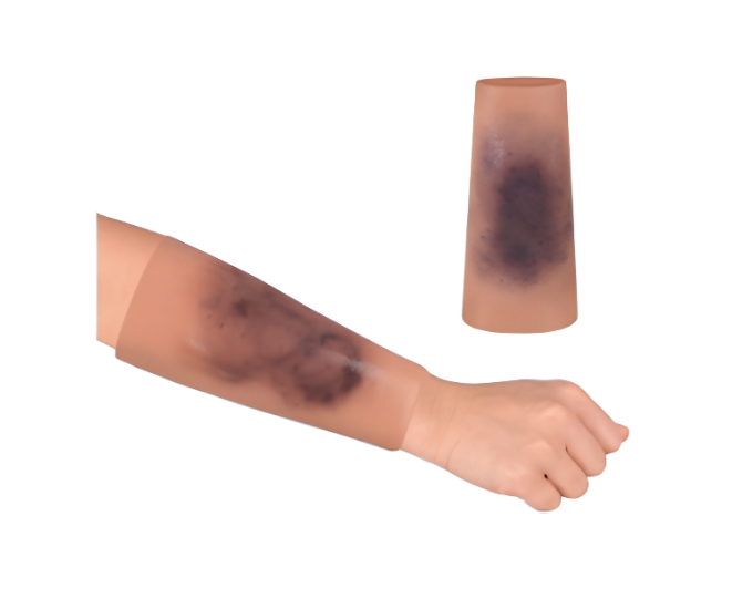 Wearable Bruise Wound Sleeve - Product Image