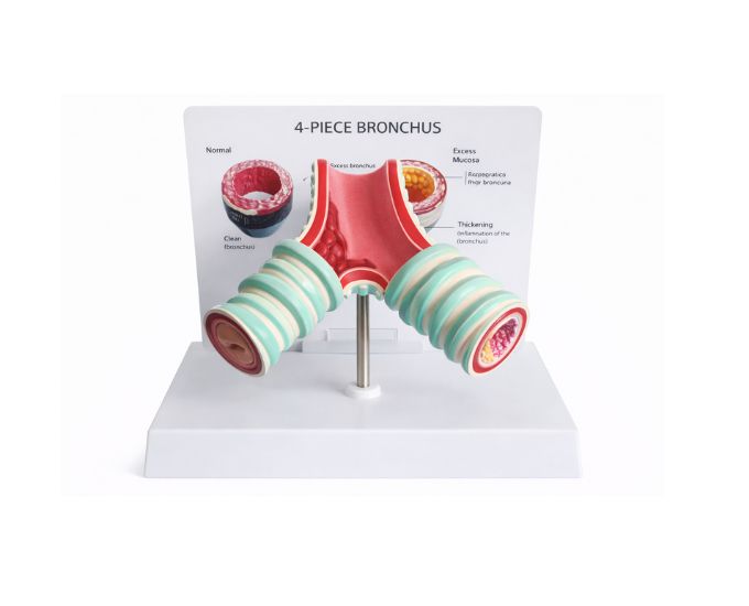 Tracheal Pathology Study Model for Respiratory Anatomy - Product Image