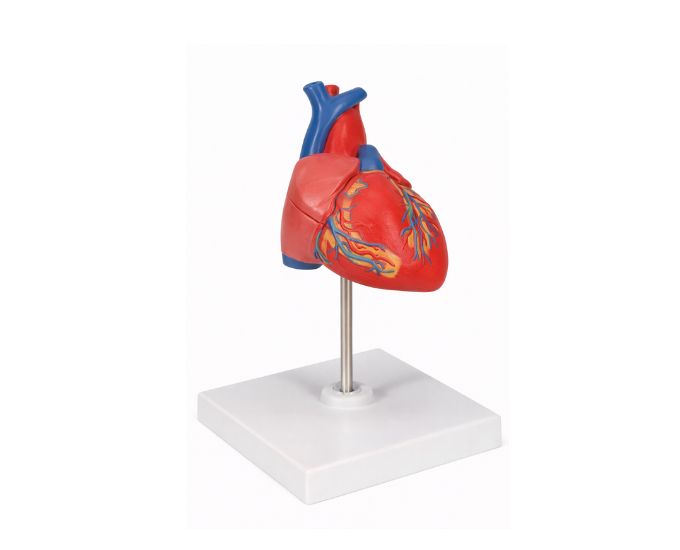 Human Heart Anatomy Model with Diseased Artery Life Size MT-132 - Product Image