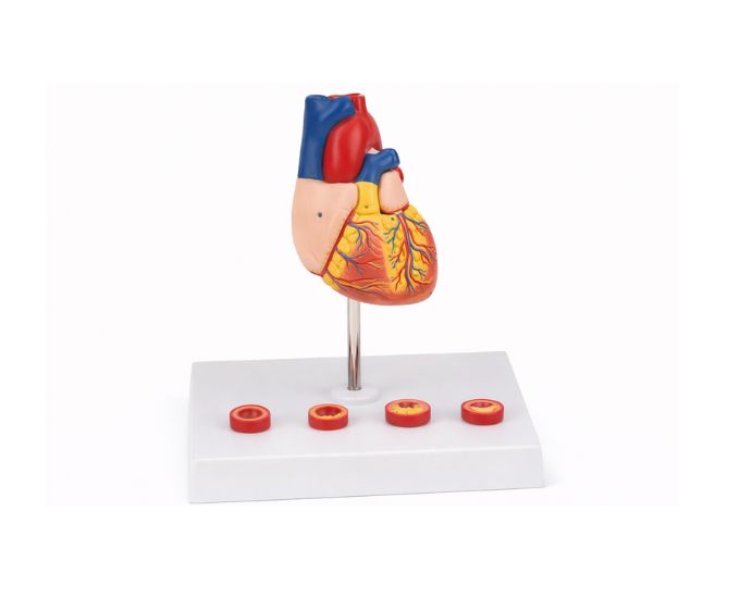 Human Heart Anatomy Model with Diseased Artery Life Size MT-133 - Product Image