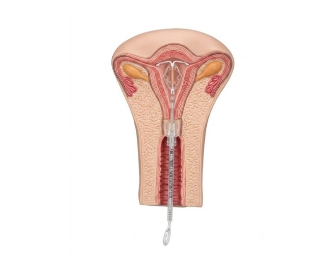 Intrauterine Model - Product Image