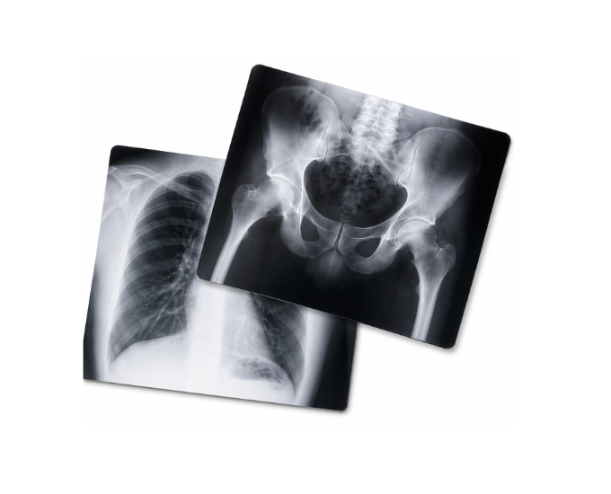 X-Ray View Box & Film for Diagnostic Imaging & Radiology Applications - Product Image 3