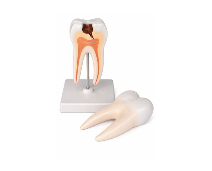 Enlarged Tooth Anatomy Model 2 Parts for Dental Education - Product Image
