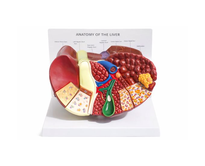 Life Size Advanced Liver Cancer Anatomical Study Model - Product Image
