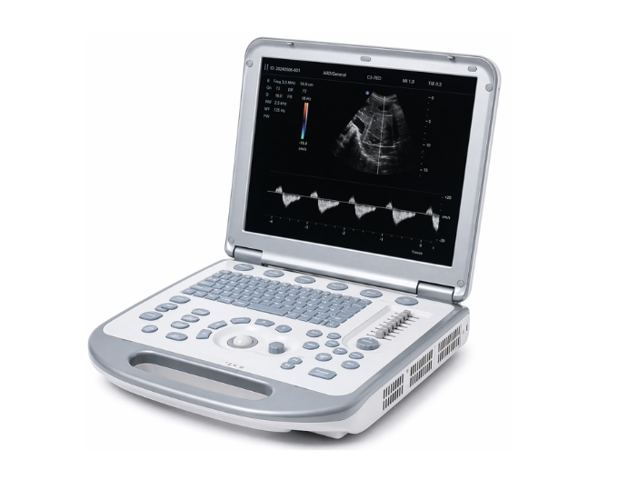 Color Doppler Ultrasound System for Advanced Vascular & Cardiac Imaging