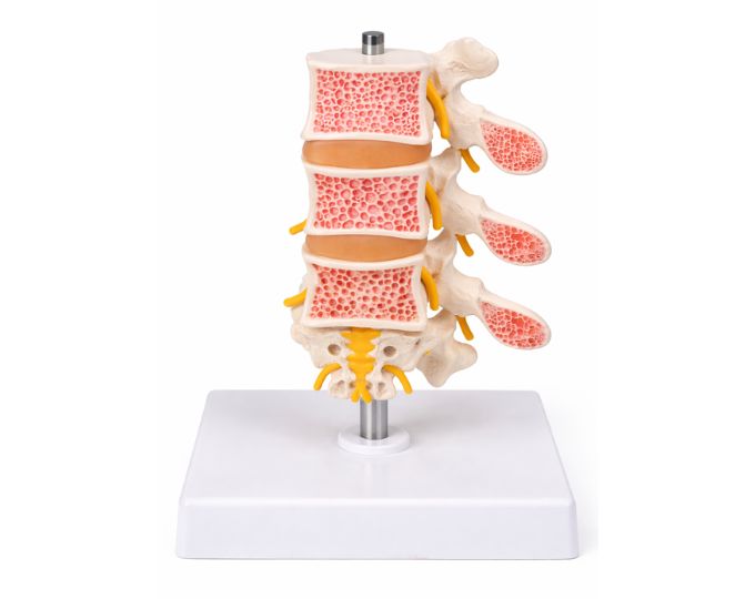Osteoporosis bone model 4 bones