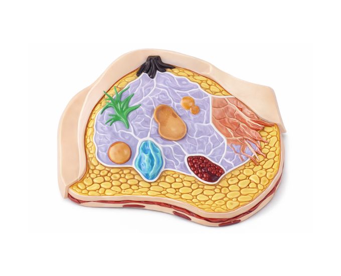 Pathological Breast Anatomy Demonstration Model - Product Image
