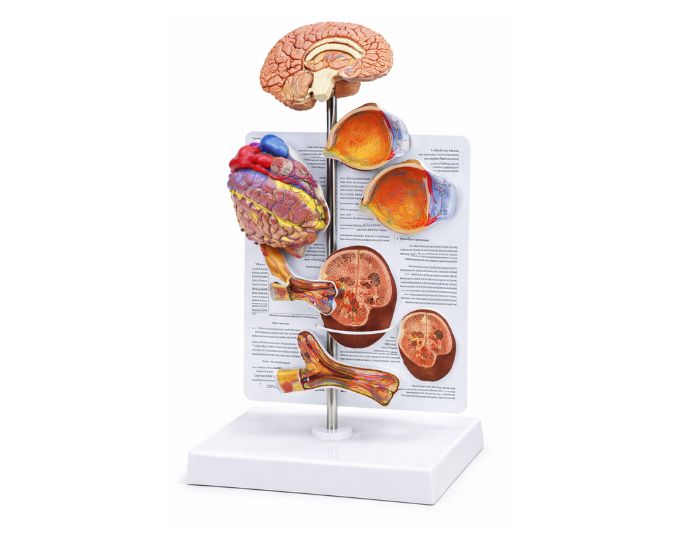 Hypertension Educational Display Model for Medical Training - Product Image