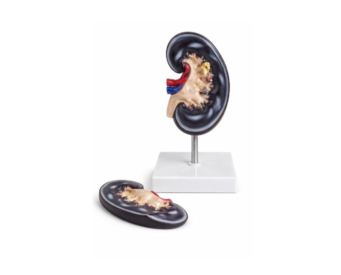 Professional Kidney Sectional Anatomy Model for Laboratory Study - Product Image