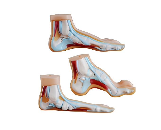 Foot Anatomy Model (Normal, Flat and Arched Foot) - Product Image