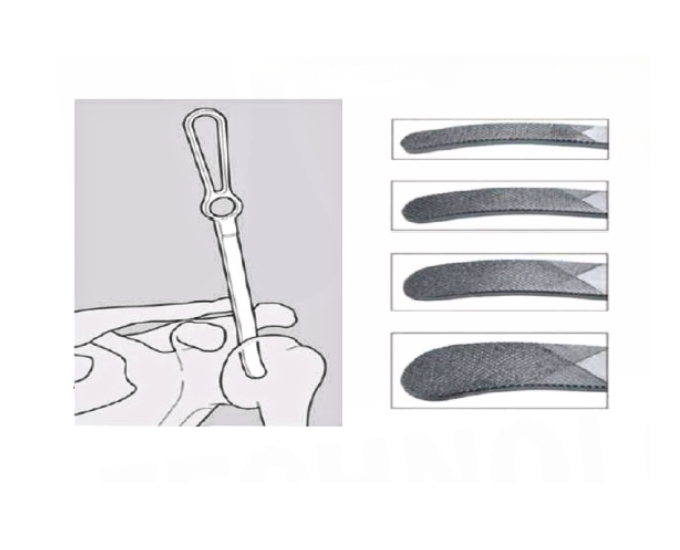 Darrach Acromial Elevators Orthopedic Surgical Instrument Set - Product Image 2