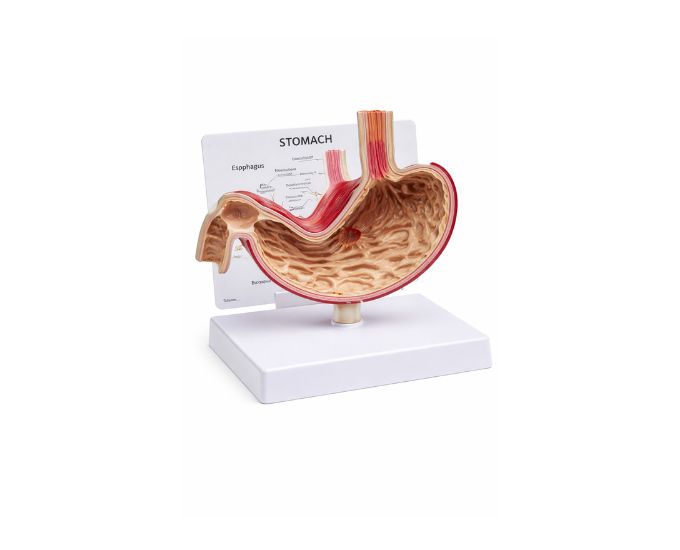 Life Size Diseased Stomach Dissection Teaching Model - Product Image