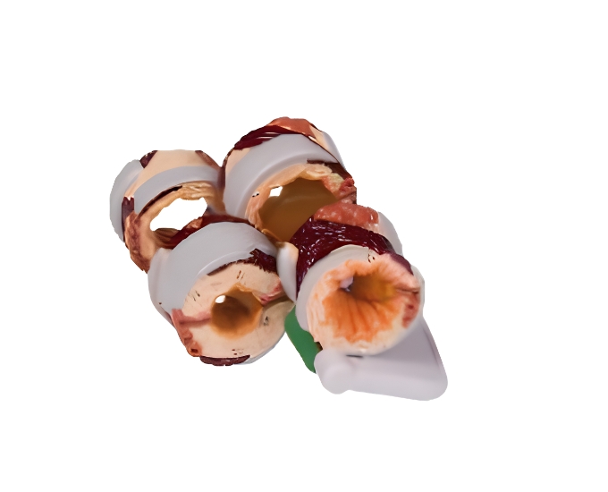 4PC Bronchus Model - Product Image