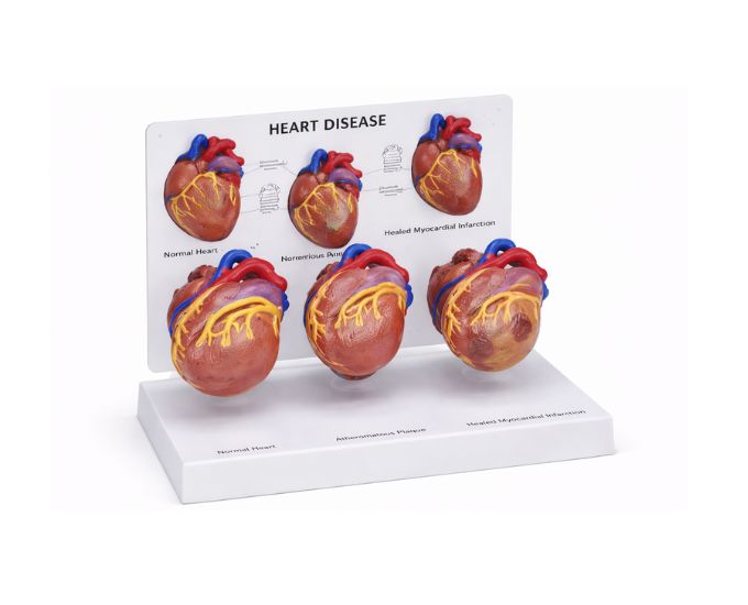 Human Heart Anatomy Model Life Size, 3-in-1 MT-130 - Product Image