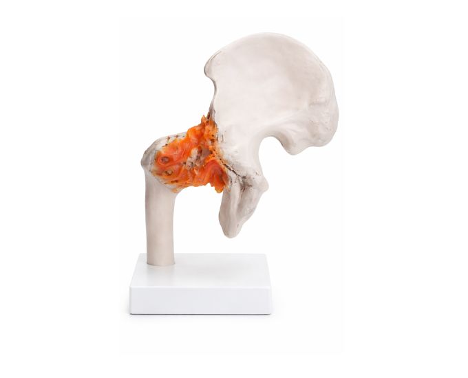 Human Hip Joint Anatomy Model Life Size Study Display - Product Image