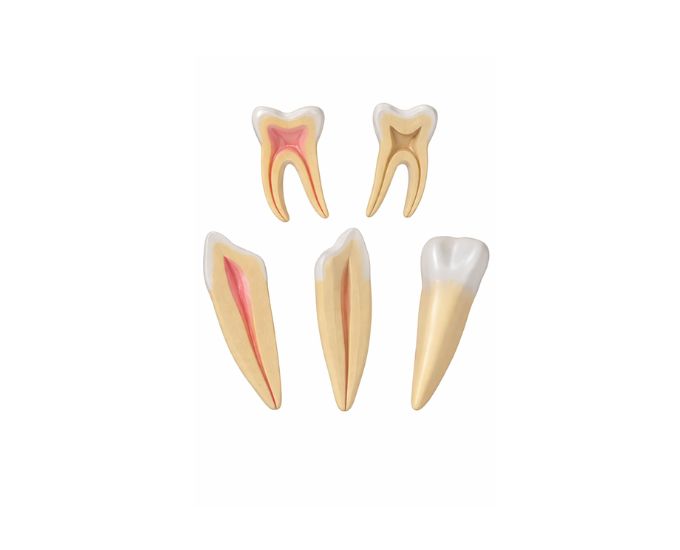 Anatomy of Enlarged Teeth Model Set Canine Incisor Molar 12X - Product Image
